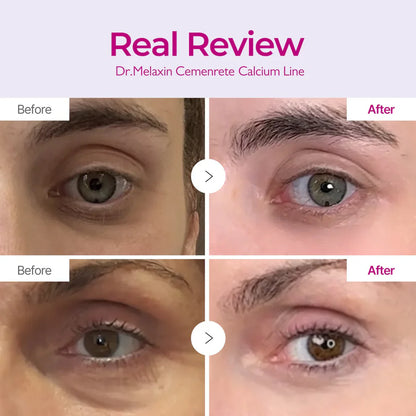 Calcium Volume Multi Balm & Eye Patch 60ea [TikTok Bestseller]