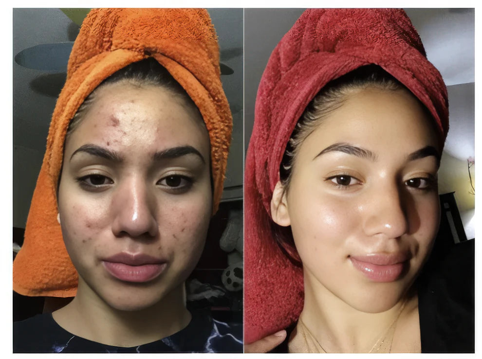 Radiant Blowout Routine Set [TikTok Bestseller]